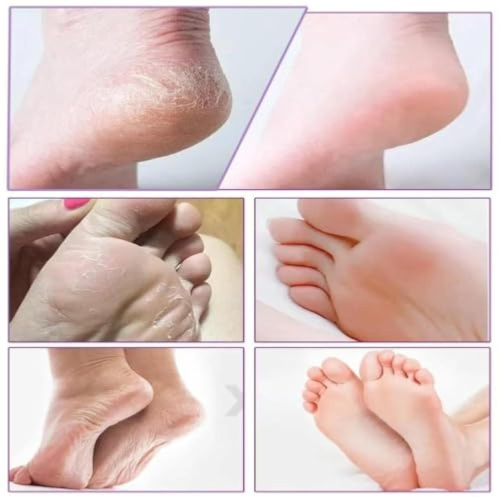 Goat Milk Foot Peel Mask with Nicotinamide