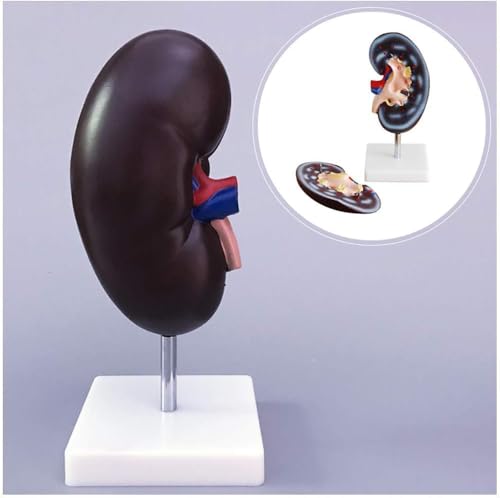 Modèle de rein humain d'anatomie médicale structures détachables luxe