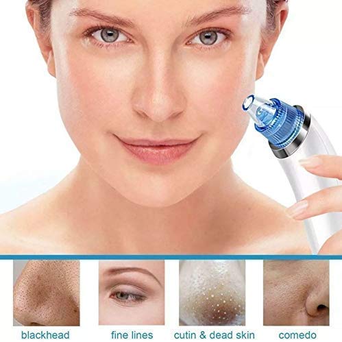 Image of Beautiful Skin Care Expert Acne Pore Cleaner Vacuum Blackhead Remover Kit Skin Cleaner, Pimple Removal Tool, Acne Removal Tool, Blackhead Remover Tool For Girls Women