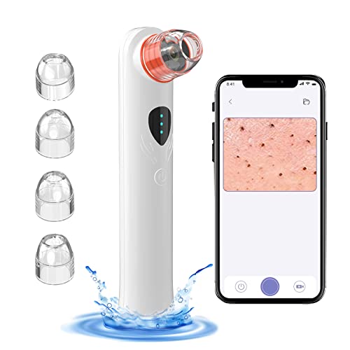 Blackhead Remover Vacuum with Camera, WiFi Visible Facial Pore Vacuum Cleanser with Pimple Acne Comedone Extractor with 4 Suction Heads Electric Black Head Suction Tool