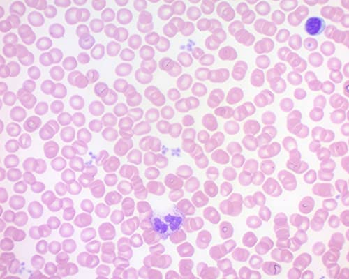 Wright-Giemsa Stain Pack, 1000ml