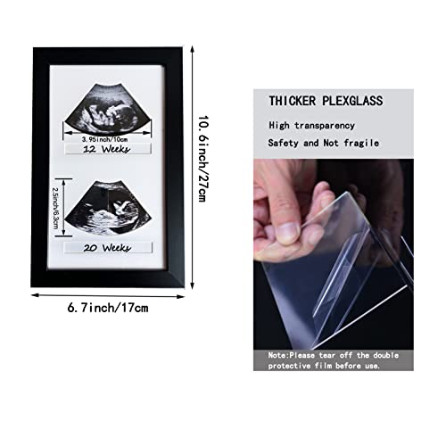 Ultrasound Picture Frames,Sonogram Picture Frame 2 Photos,Ultrasound Frames For Baby,Baby Ultrasound Picture Frame, Pregnancy Picture Frame,Pregnancy Announcements,Black,Nursery Picture Frames #TOP1