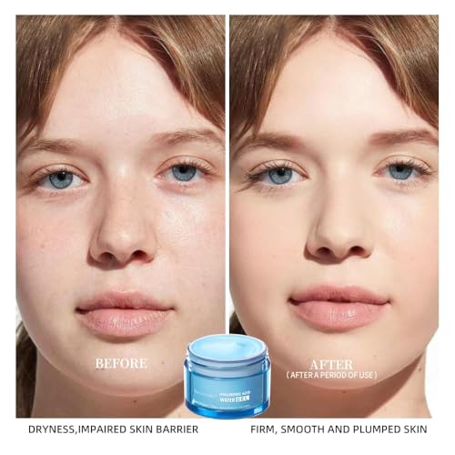 ZxjwT Hydro Boost Hyaluronic Acid Moisturizing Cream, Face Moisturizer For Oil Skin, Hyaluronic Acid Formula Combined With Water,Lightweight and 24 Hours Of Long-lasting Hydration-1.76Oz (Cream)