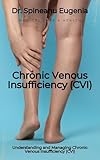 Understanding and Managing Chronic Venous Insufficiency (CVI)
