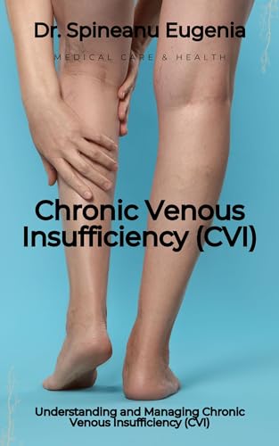 Understanding and Managing Chronic Venous Insufficiency (CVI)