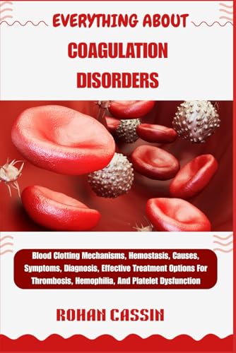 EVERYTHING ABOUT COAGULATION DISORDERS: Blood Clotting Mechanisms, Hemostasis, Causes, Symptoms, Diagnosis, Effective Treatment Options For Thrombosis, Hemophilia, And Platelet Dysfunction