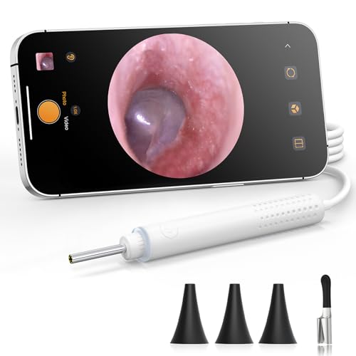 ScopeAround Otoscope with Light - 720P Ear Camera, USB-C