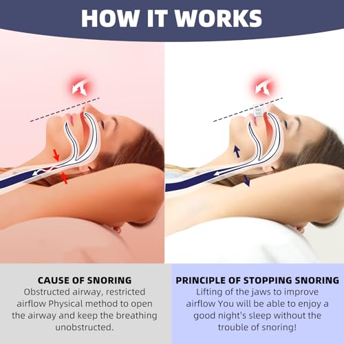 Anti Snoring Devices, Men and Women Electric Snoring Stopper Suitable,Twin Turbine Electric Adjustable Wind Speed, White - 007