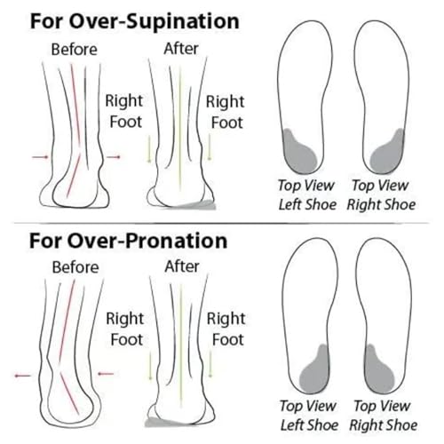 2025 Summer Orthopedic Sandal Diabetic Walking, Women's Summer Fisherman Sandals, Adjustable Ankle Strap Open-Toe3