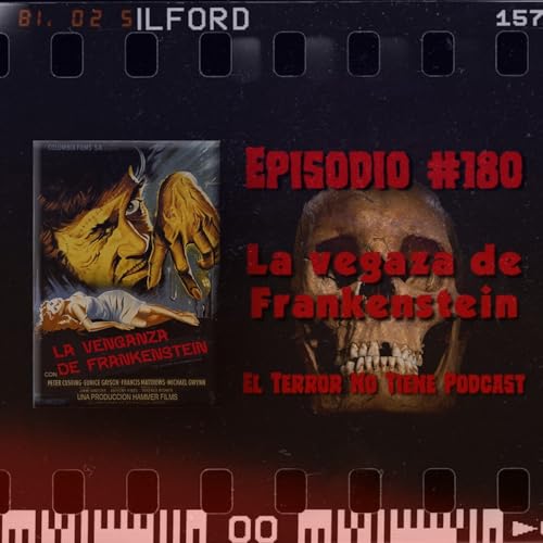 El Terror No Tiene Podcast - Episodio #180 - La venganza de Frankenstein (1958) cover art