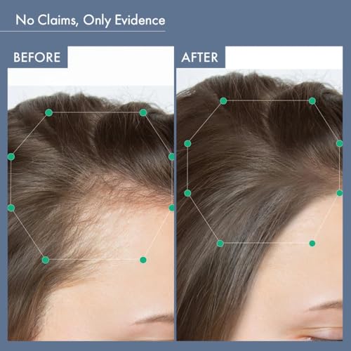 Image of ThriveCo Women's All-in-one Hair Vitamin with Biotin, Omega 3, Vitamin-E, Ashwagandha and Natural Extracts, 60 Capsules | Best Hair Growth Vitamin For Hair Fall Control, Regrowth & Follicle Strength | 100% DRUG FREE