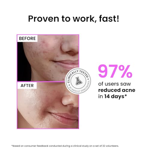 FoxTale Store FoxTale 12% Niacinamide Face Serum 10 ml - Image 5