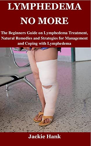 LYMPHEDEMA NO MORE: The Beginners Guide on Lymphedema Treatment