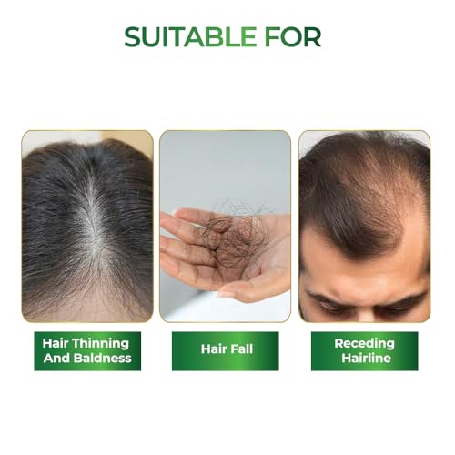 Image of Streax Rosemary Hair Spray - 200ml , 100% Natural Extracts For Hair Growth , Stronger & Thicker Hair, Reduces Hair Fall , Nourishes Scalp & Stimulates Roots , Non-Sticky , Sulphate & Paraben-Free, Rosemary Water Spray for Hair Growth