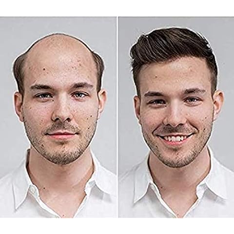 Natural Hairline Toupee 100% Human European Hair System Thin Skin Hair Unit for Men 8X9 Inch Hair Replacement System Hairpiece Natural Color Cover