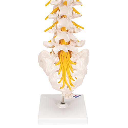 Image of 3B Scientific A76 /5 Lumbar Spinal Column with Dorso-Lateral Prolapsed Intervertebral Disc, 13.4 inch Height