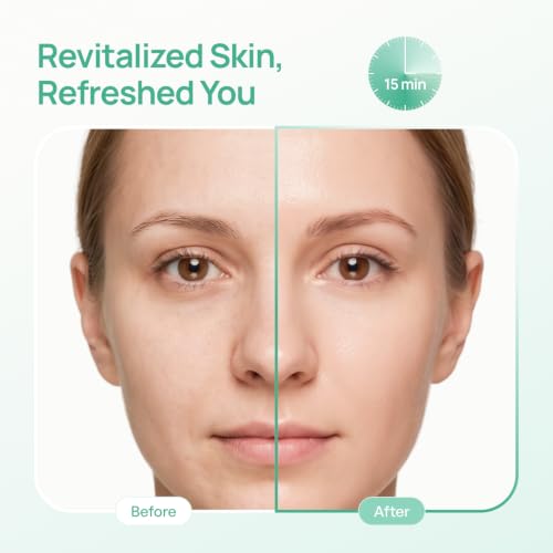 Image of PLANTIFIQUE Korean Sheet Mask, 5 Pack - Hydrating & Nourishing Face Masks with Aloe Vera, Ceramide NP and Hyaluronic Acid - Mascarillas Faciales