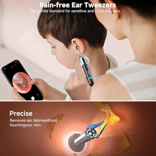 BEBIRD R1 Ultra Ear Wax Removal, Ear Cleaner with Camera Ear Scope, Wax Remove Ear Pick with Ear Otoscope Tweezers, Visual Dropper Cleaning Kit, Ear/Nose/Throat Examination Tool for Family - Image 6