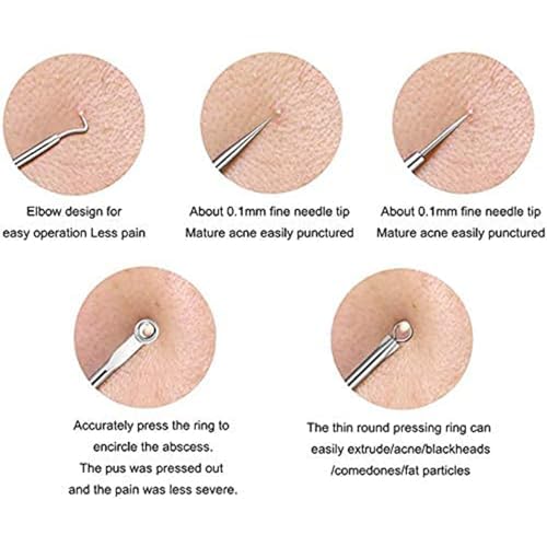 Image of Stainless Steel Blackhead Remover Comedone Extractor, Curved Blackhead Tweezers Kit, Acne Pimple Blemish Remover Tool- Set of 4 for Face, Nose, and Acne Treatment (Pack of 2)