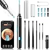 Ear Wax Removal Tool Camera, 1080P HD Ear Camera & 6 LED Lights, Easy and Safe Ear Cleaner for Kids & Adults, Ear Cleaning Kit Includes 8 Ear Tips and 7 Traditional Tools for iPhone, iPad, and Android
