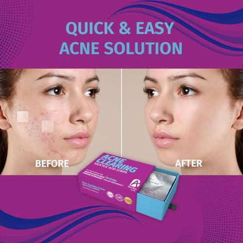 Image of BonAiyu Acne Pimple Patch | 24 Hydrocolloid + Salicylic Acid Waterproof Patches | For Active Surface Acne | Absorbs Pimple Overnight | Reduces Excess Oil | All Skin Types | Safe Formulations