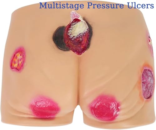 Geriatric Decubitus Ulcer Nursing Model, Bed Sore Care Simulator, Multi-Degree Ulcer Simulation, Realistic Human Body Model, for Medical Skills Training and Elderly Care Teaching