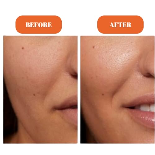 GLOWICTION Radiance Maximising Vitamin C Serum - 10% Pure Stable Vitamin C Face Serum for Glowing Skin - Non-Sticky, Fast Absorbing Brightening & Anti-Aging Formula - No Pilling Under Makeup - 30ml
