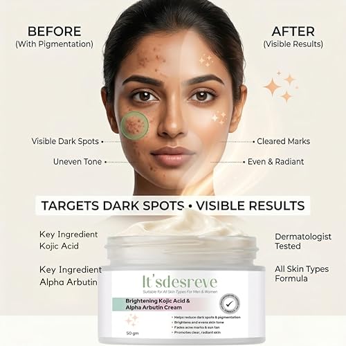 Image of Kojic Acid Cream for Dark Spots, Pigmentation, Melasma & Acne Marks Removal with Alpha Arbutin | Skin Brightening Cream for Men & Women | Uneven Skin Tone Corrector 50g