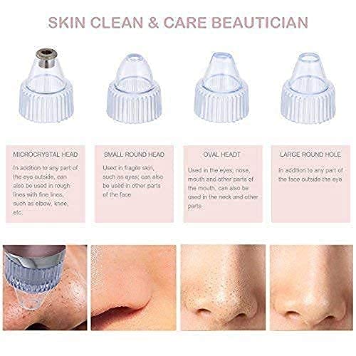 Image of BINSBARRY4 in 1 Multi-Function Blackhead Whitehead Extractor Remover Device - Acne Pimple Pore Cleaner Vacuum Suction Tool for Men and Women (White)