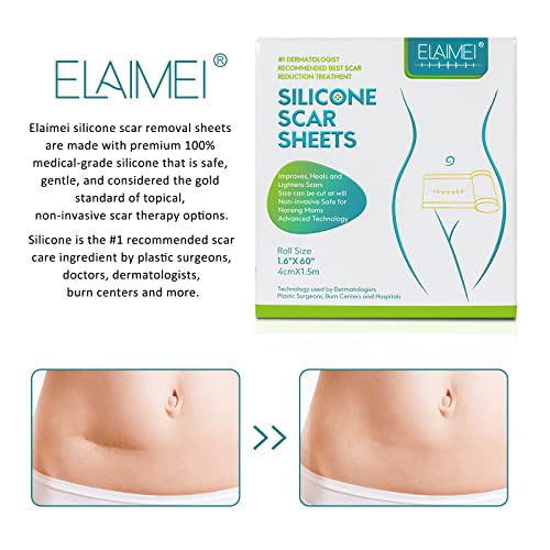 Fita de cicatriz de silicone, reutilizável, tratamento de cicatriz, adesivo profissional de tratamen