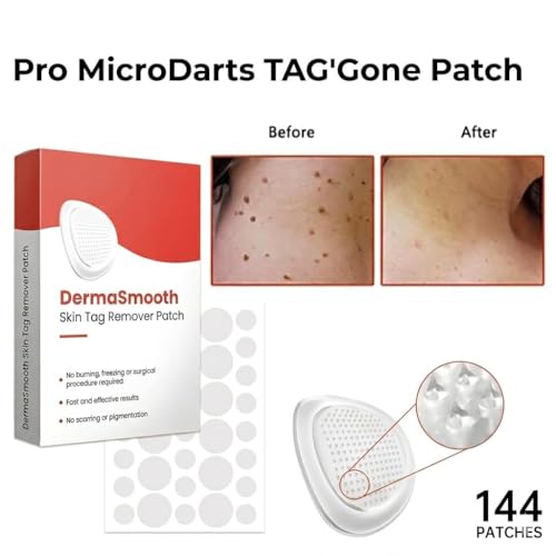 Image of DermaSmooth Skin Tag Patches | Invisible Adhesive Spot Covers for Face, Neck & Body | Gentle Skin Care Patch Sheets (White color) (144 Patches)
