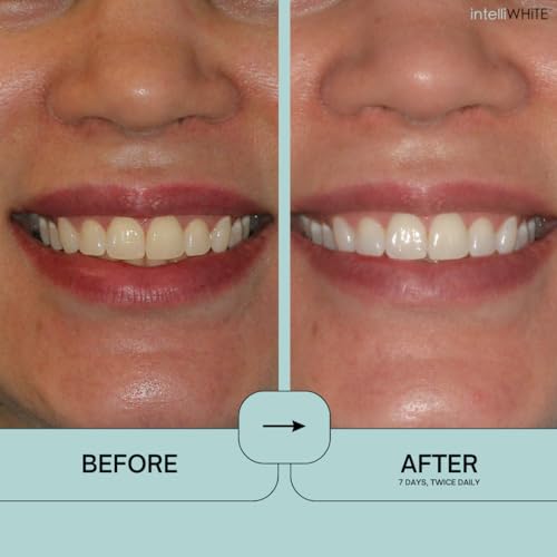 Image of IntelliWHiTE ProStrips Teeth Whitening Strips, 14 Day Treatment, Whitens Up to 12 Shades, Enamel-Safe Gentle Remineralizing Formula, Dentist Formulated for Sensitive Teeth, (28pk Mint Flavor)