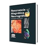  RESONANCIA MAGNETICA NEUROGRAFICA