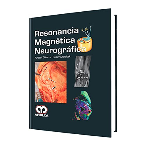 Resonancia Magnetica Neurografica