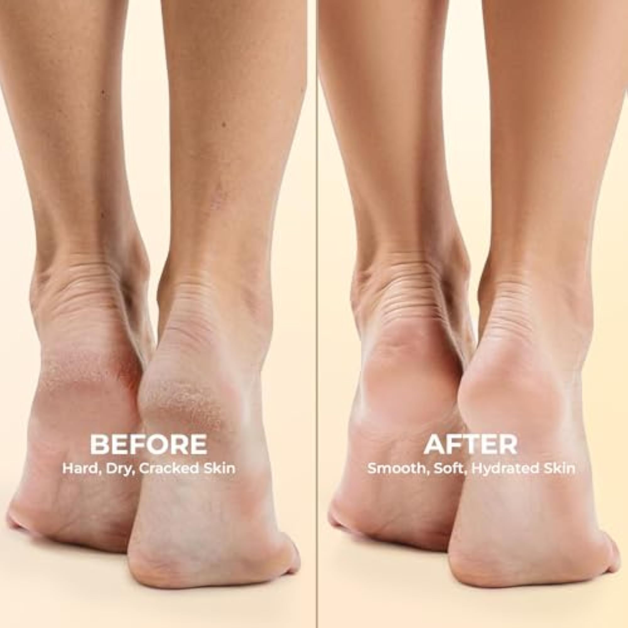 Crack Heal Foot Cream for Dry, Rough Heels, 50ml