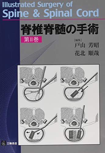 楽天 無料電子書籍 脊椎脊髄の手術 第Ⅱ巻 バイ
