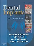 Dental Implants: The Art and Science, 2e