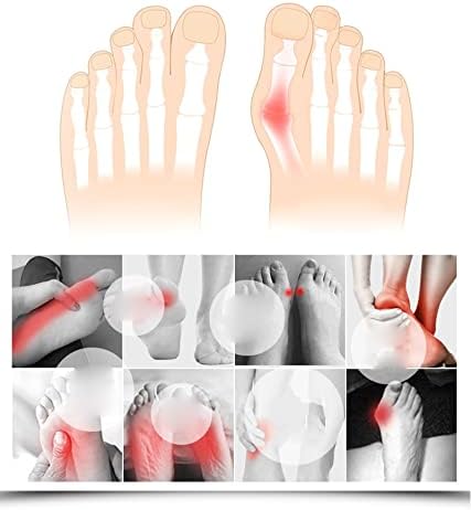 MUSUMI 2Pcs Bunion Corrector Hallux Valgus Corrector Relief Pain Toe Separators Pedicure Tool Bone Thumb Orthopedic Braces Foot Protector Splint (Clear L)