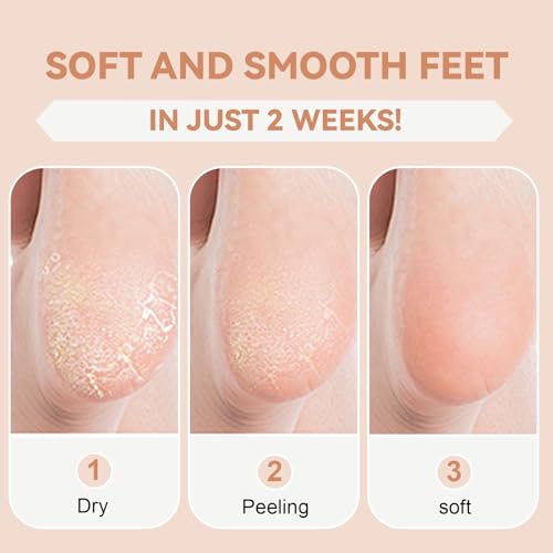 Fangshu Silikonsocken, Rutschfeste Feuchtigkeitsspendende Socken Elastische Silikon Socken Foot Peeling Anti Hornhaut für Rissige Füße Trockene