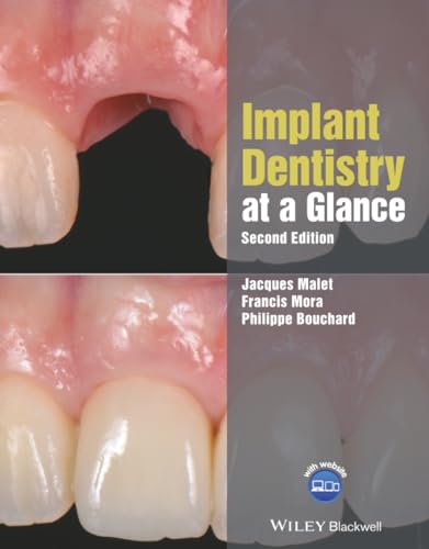  Implant Dentistry at a Glance
