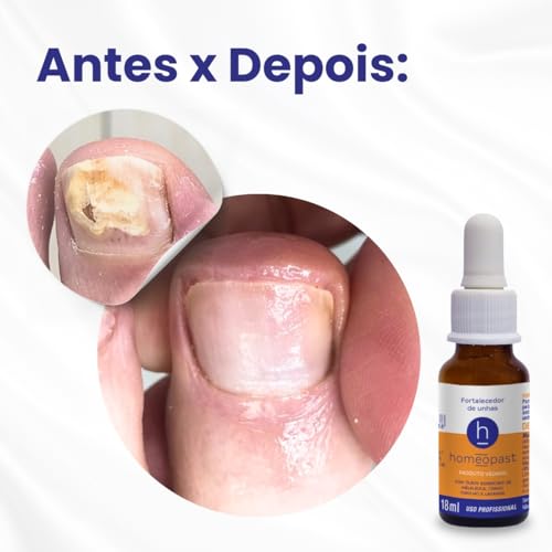 Fortalecedor Vegano de Unhas Danificadas - homeopast 18ml - Tratamento Restaurador