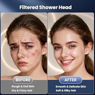 YEAUPE PRO Soffione Doccia con Filtro a 25 Fasi, Soffione Doccia ad Alta Pressione Ø 115mm con 6 Getti Regolabili, Doccia Anticalcare con 2 Filtri di Ricambio, Purificazione Acqua, Cromato Universale