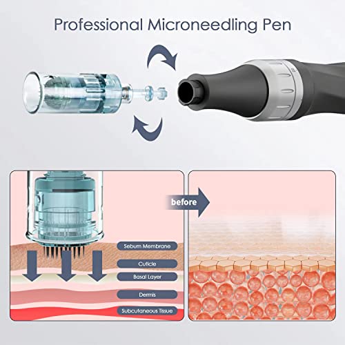 Professional-Microneedling-Pen-Wireless-Adjustable-Micro-Needling-Microneedle-Machine-Derma-Auto-Pen-with-22-Replacement-Cartridges-4pcs-16pin4pcs-26pin6pcs-36pin6pcs-42pin2pcs-Nano