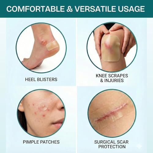 Image of Medical Grade Hydrocolloid Dressing Roll,Promoting natural healing, Cut-to-Fit, Water-Resistant, Breathable, Absorbs Fluid (5cm x 4.9 Feet)