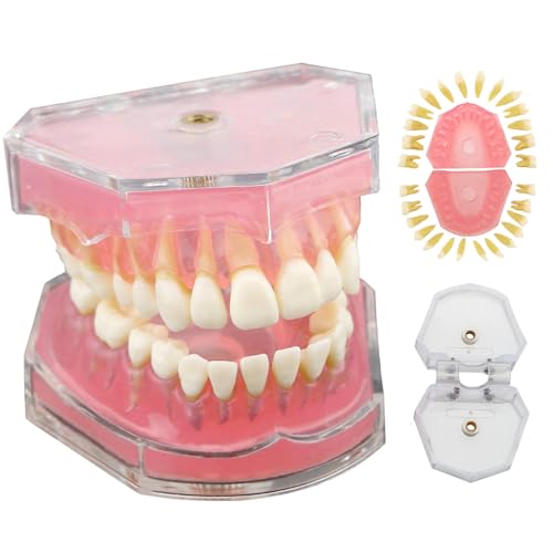 Modelo dental de tipodón con dientes desmontables para perfeccionar la práctica