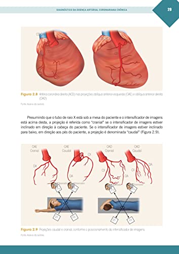 Doença Coronária Crônica