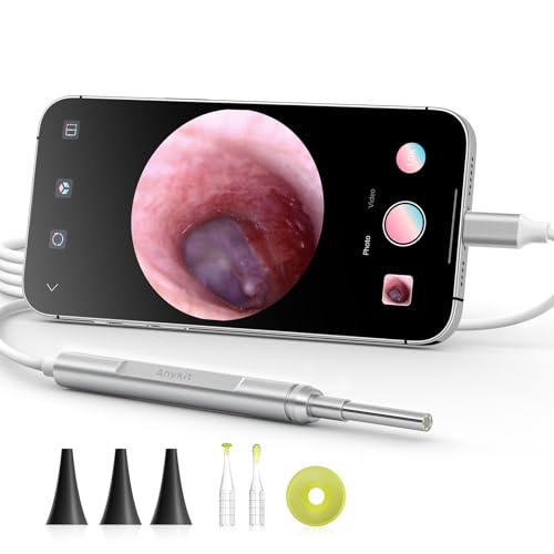 Top 10 Best Digital Otoscope For Iphone Reviews & Buying Guide Katynel