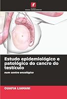 Estudo epidemiológico e patológico do cancro do testículo: num centro oncológico (Portuguese Edition) 3841680410 Book Cover