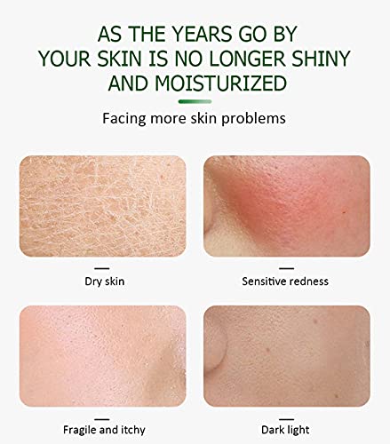 Aichun Beauty Face Serum Soothes Moisturizing Anti-Acne Repair Facial Skin Care 30Ml #TOP3
