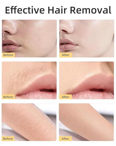 Image of Facial Hair Removal for Women, Painless Womens Facial Hair Remover with 2 Replacement Heads, Lipstick Shapes, Facial Hair Remover for Uppereh Fuzz /M